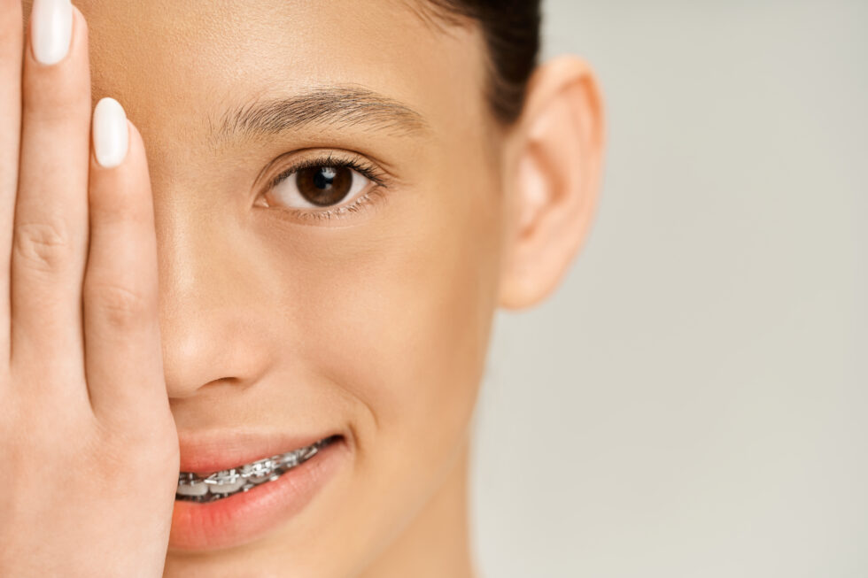 Braces Treatment